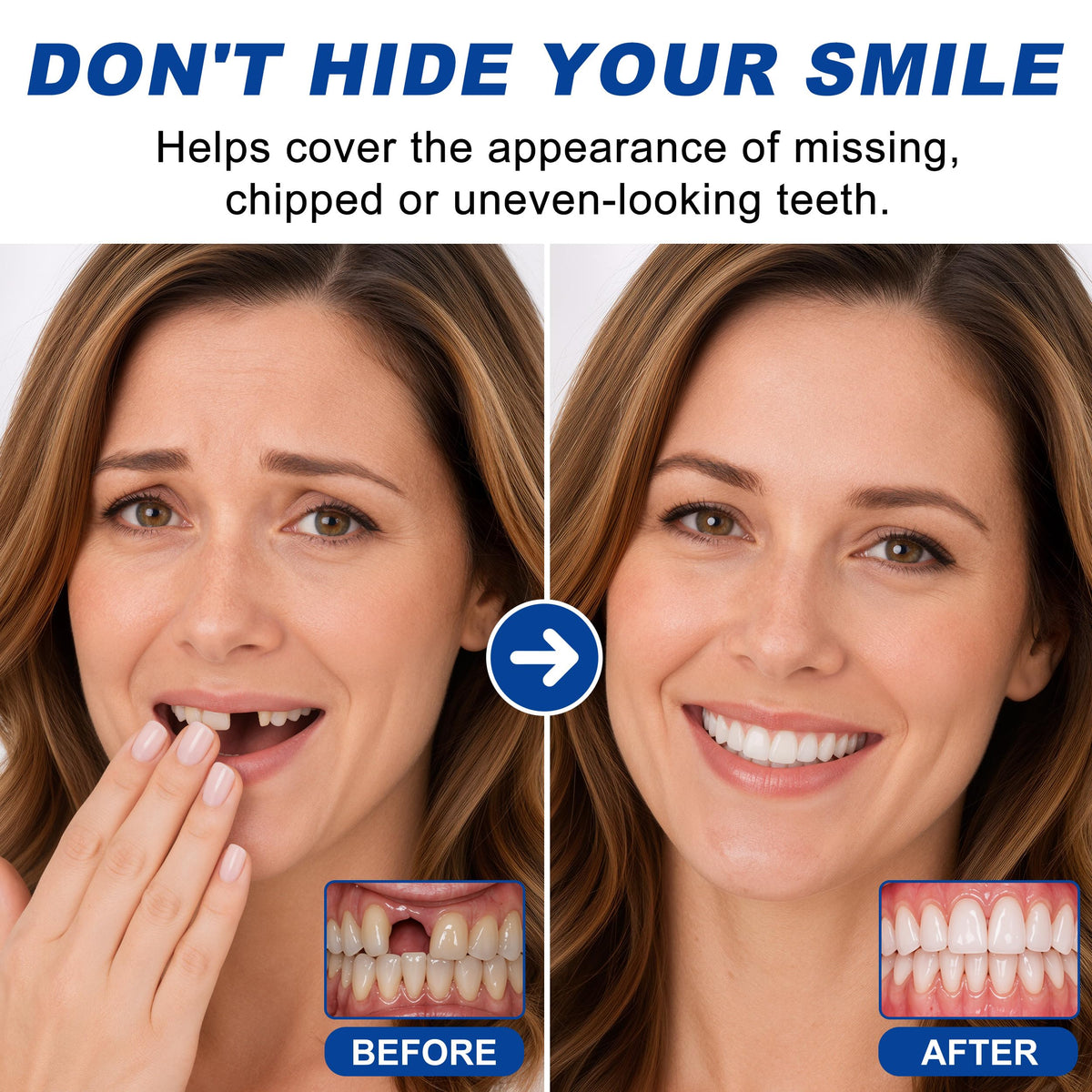 Moldable False Teeth Y678